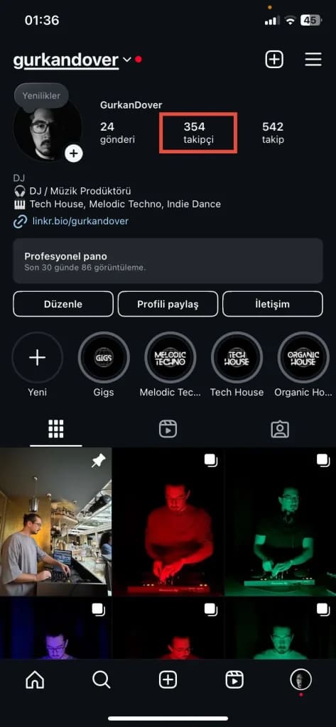 Takipçi ve Takip Edilen Listelerini Karşılaştırma